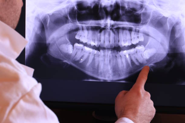 Best Emergency Dentist for Knocked-Out Tooth in Dayton, TN