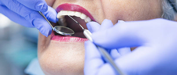 Best Emergency Dentist for Lost Fillings or Crowns in Dayton, TN